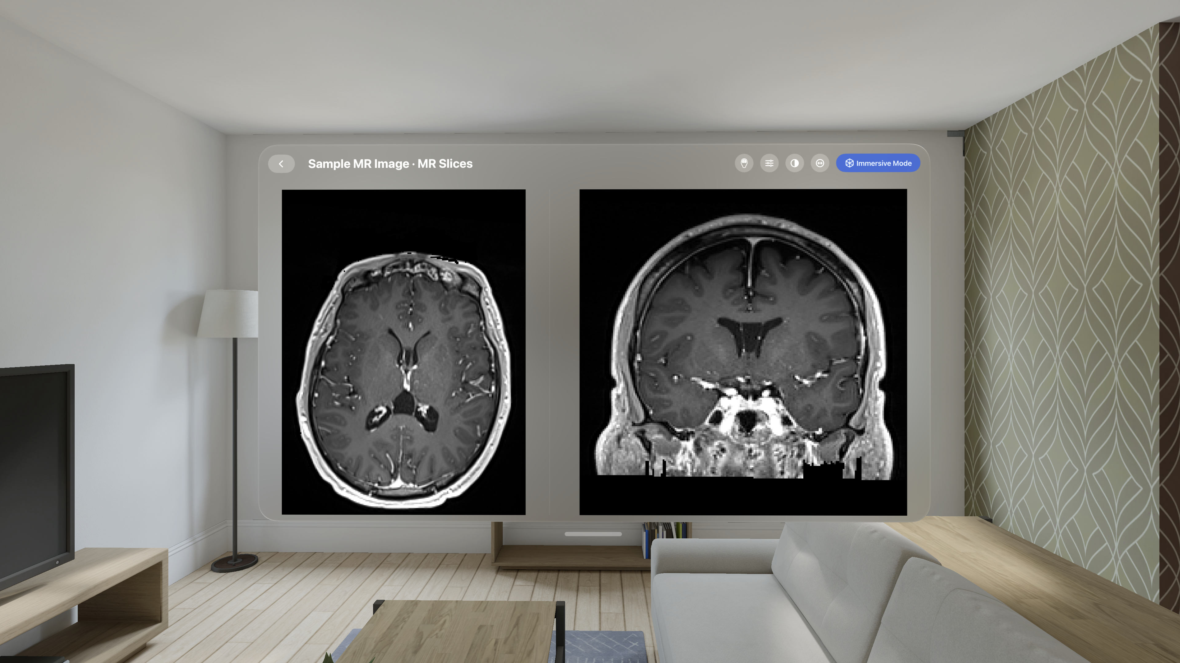 MR brain imaging