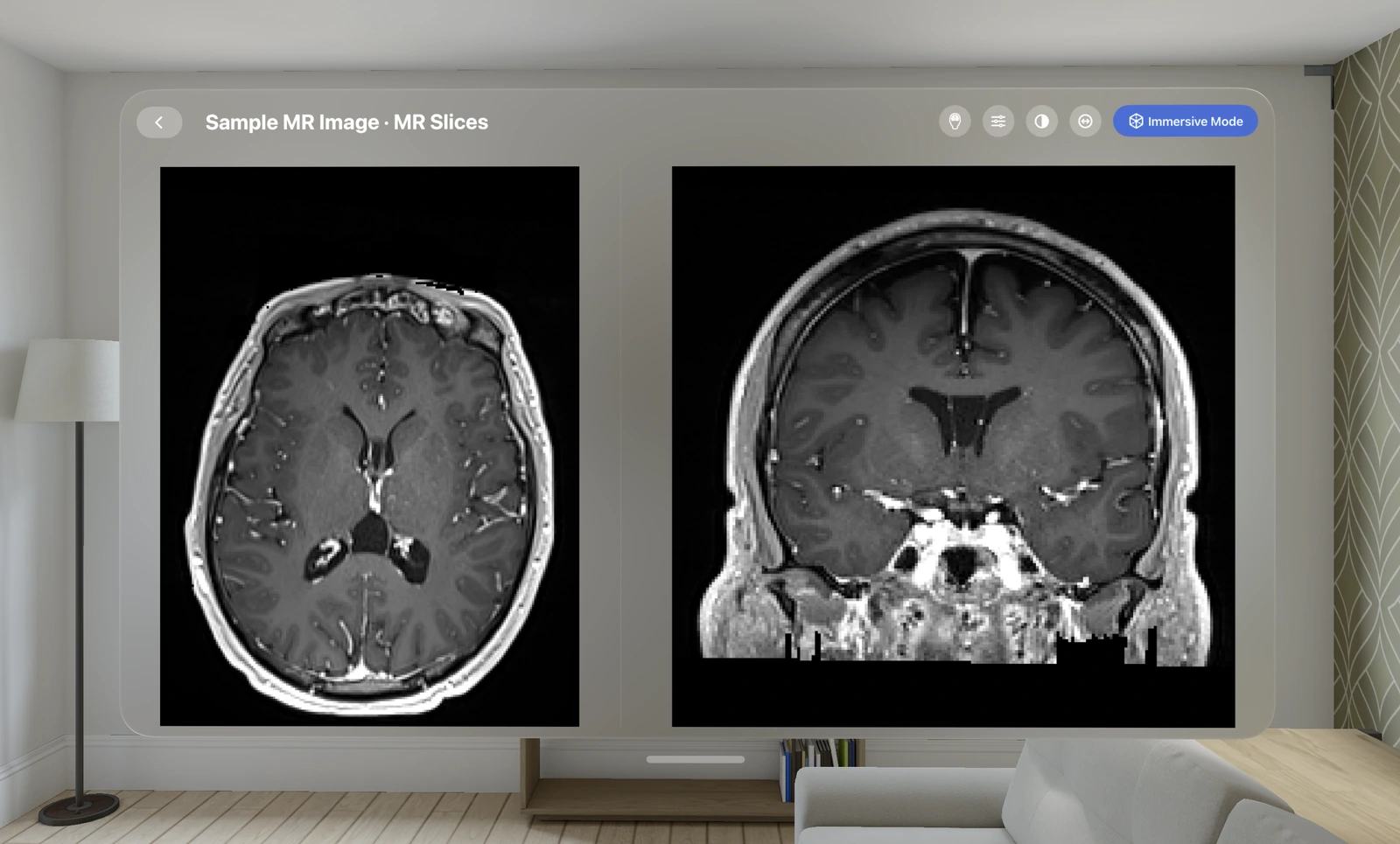 MR brain imaging